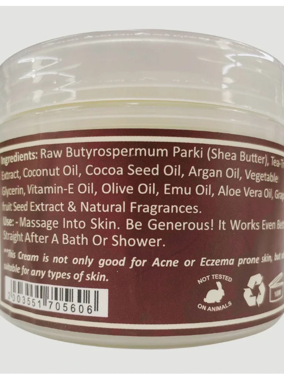 Yellow Whipped Shea Butter for Acne & Eczema